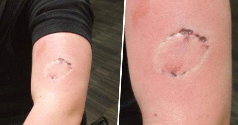 GMP officer shares photo of bite wound after being attacked by Rochdale man, The Manc