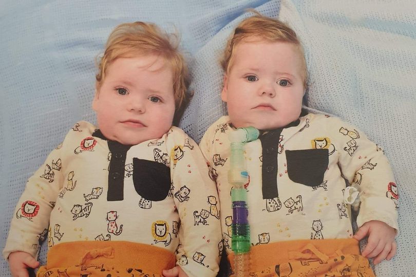 Twins from Leigh who&#8217;ve spent their entire lives in hospital allowed home for Christmas, The Manc