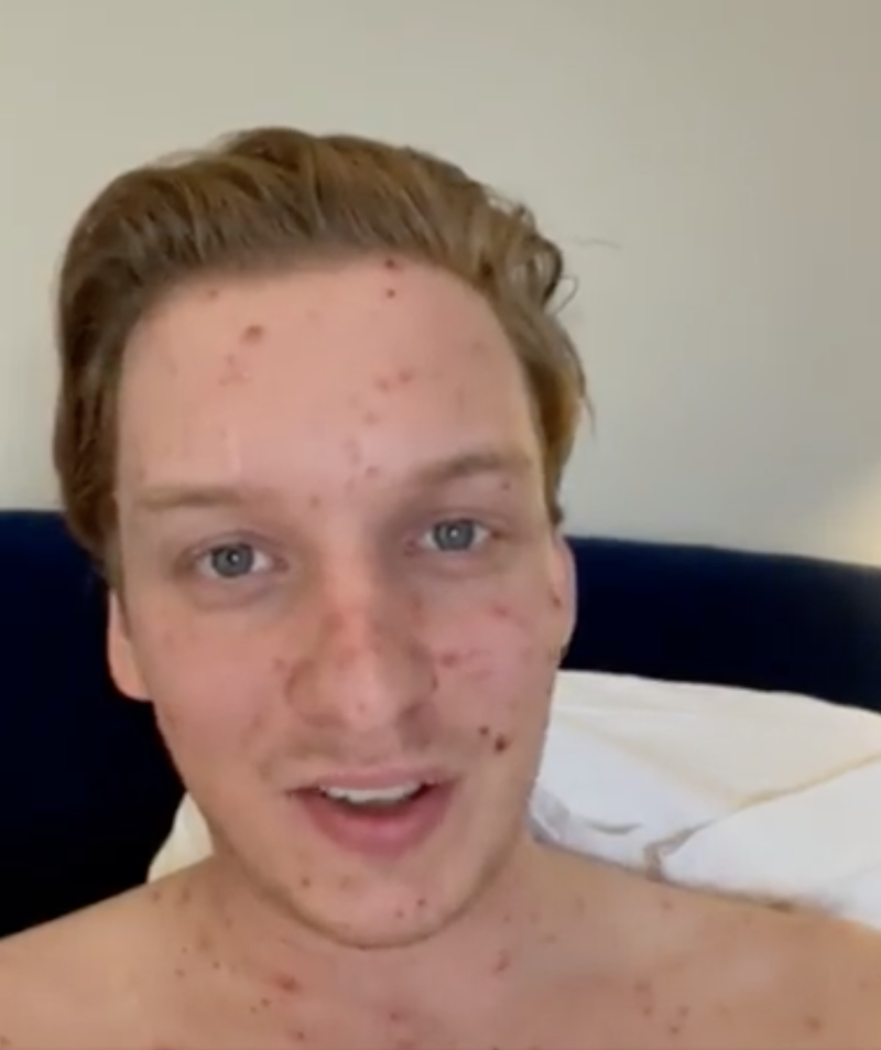 Chickenpox-ridden George Ezra pulls out of Manchester gig, apologising to fans in a video from his bed, The Manc