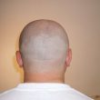 Tribunal rules that calling men &#8216;bald&#8217; is sexual harassment, The Manc