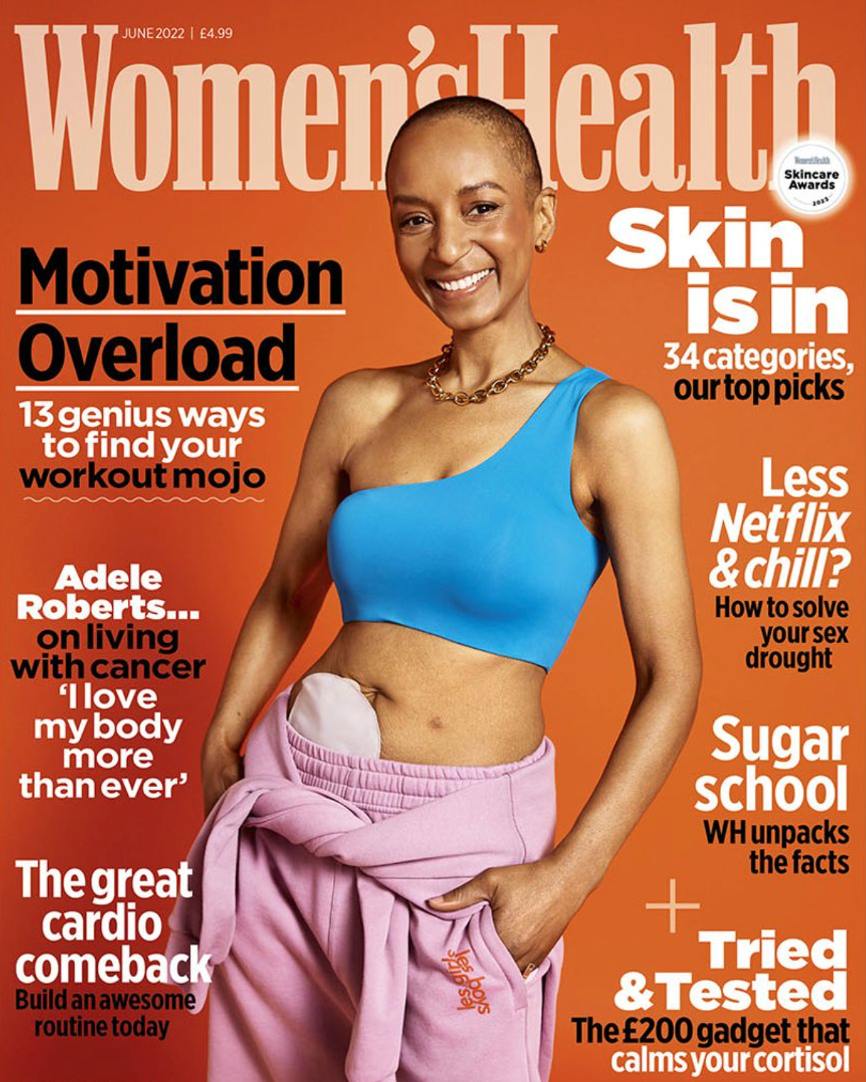 Adele Roberts praised for appearing on the cover of Women&#8217;s Health magazine with a stoma bag, The Manc