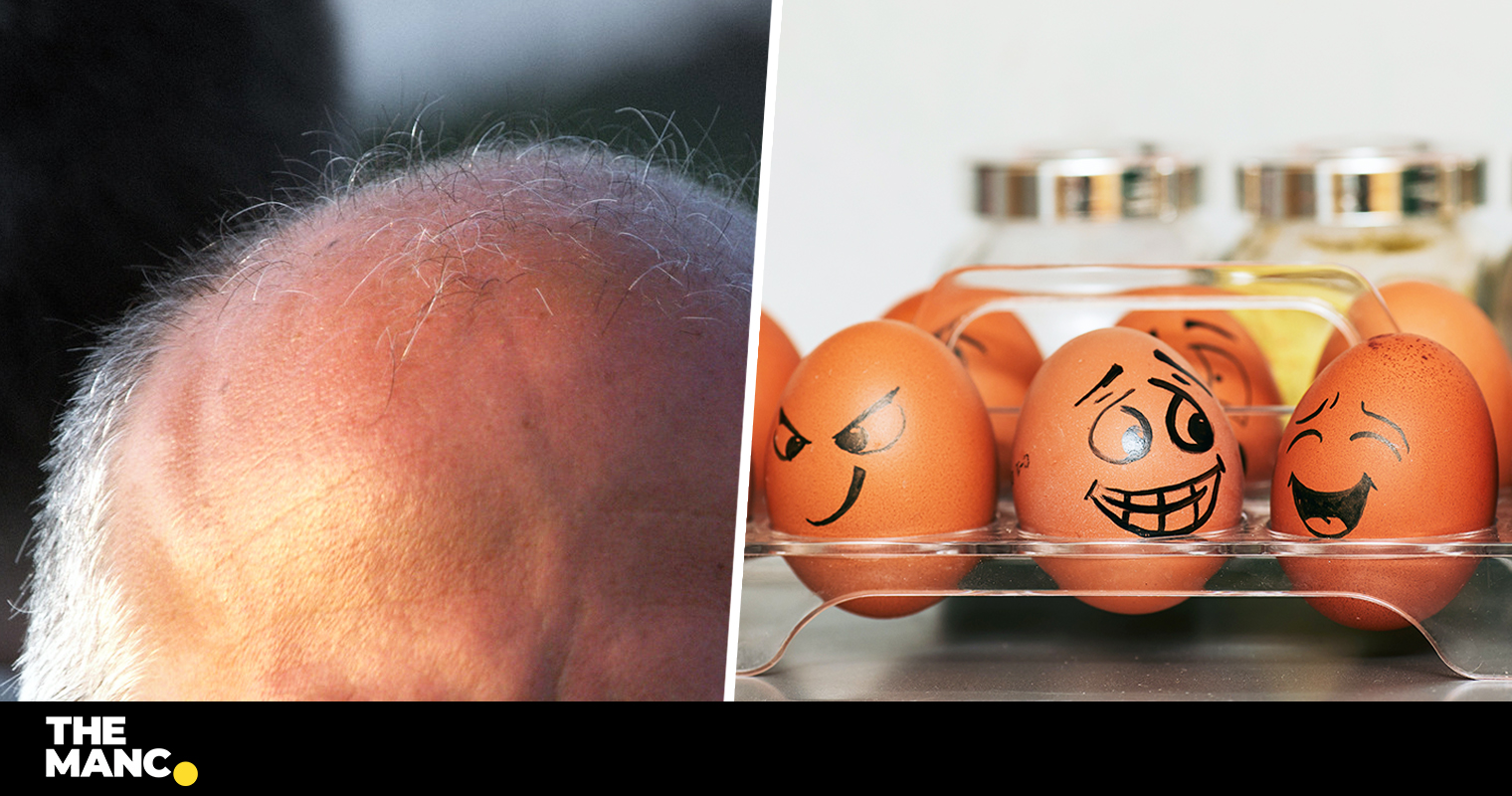 Scientists Discover Potential Cure For Baldness Thanks To New Research