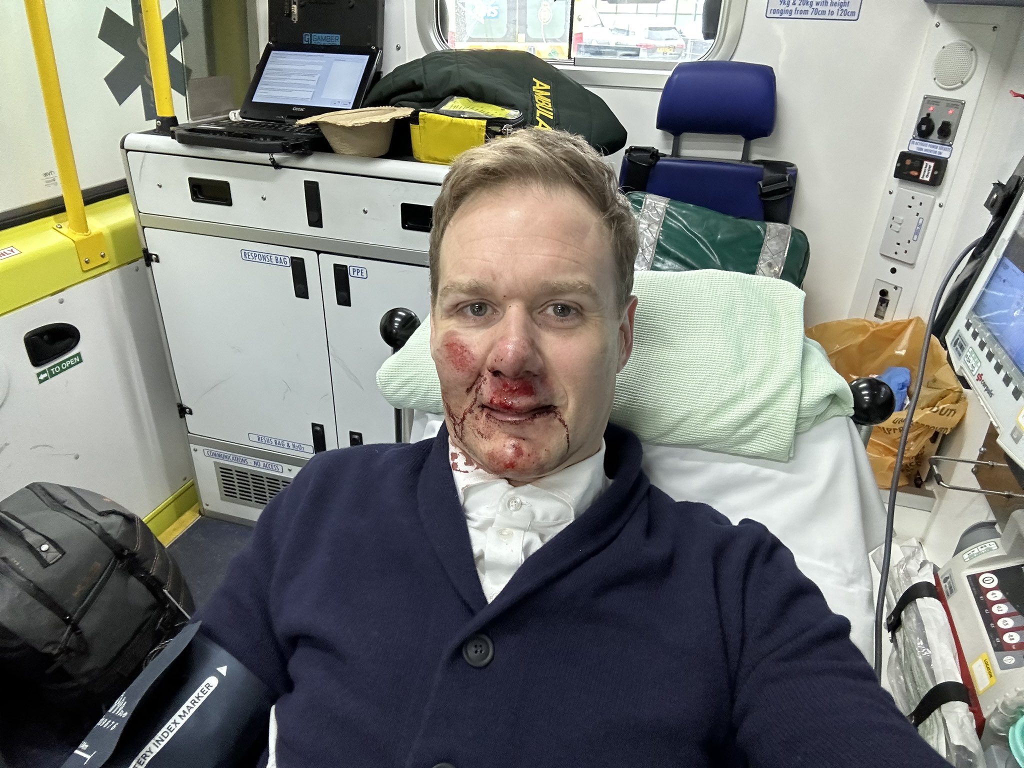 Dan Walker showing his injuries after his accident