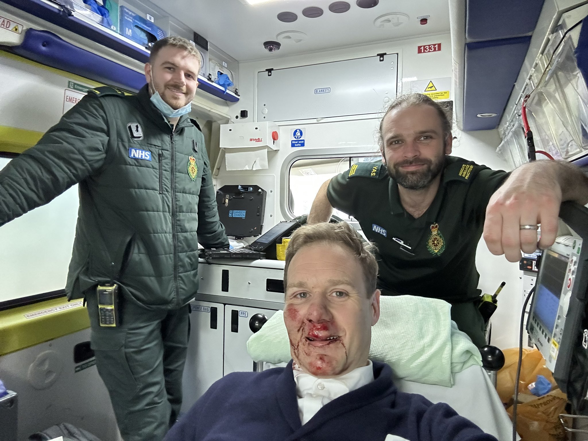Dan Walker showing his injuries after his accident