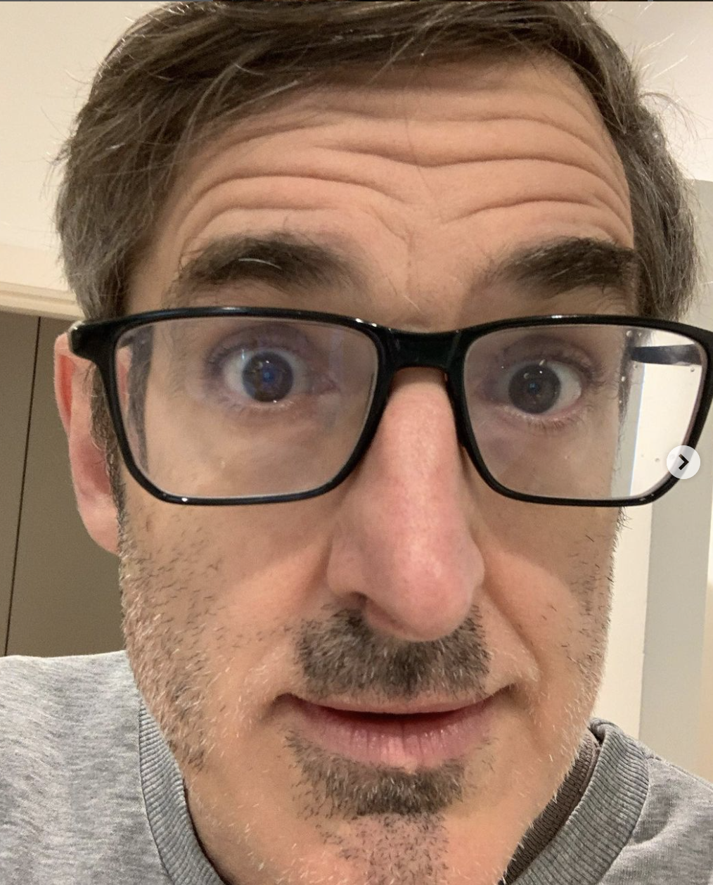 Louis Theroux showing his beard loss on 10 January. Credit: Instagram, @officiallouistheroux