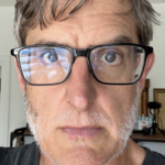 Louis Theroux's latest alopecia update