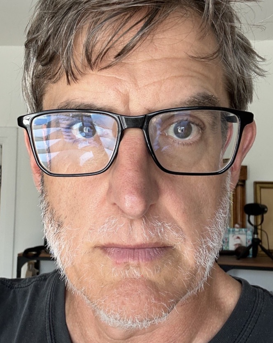 Louis Theroux's latest alopecia update