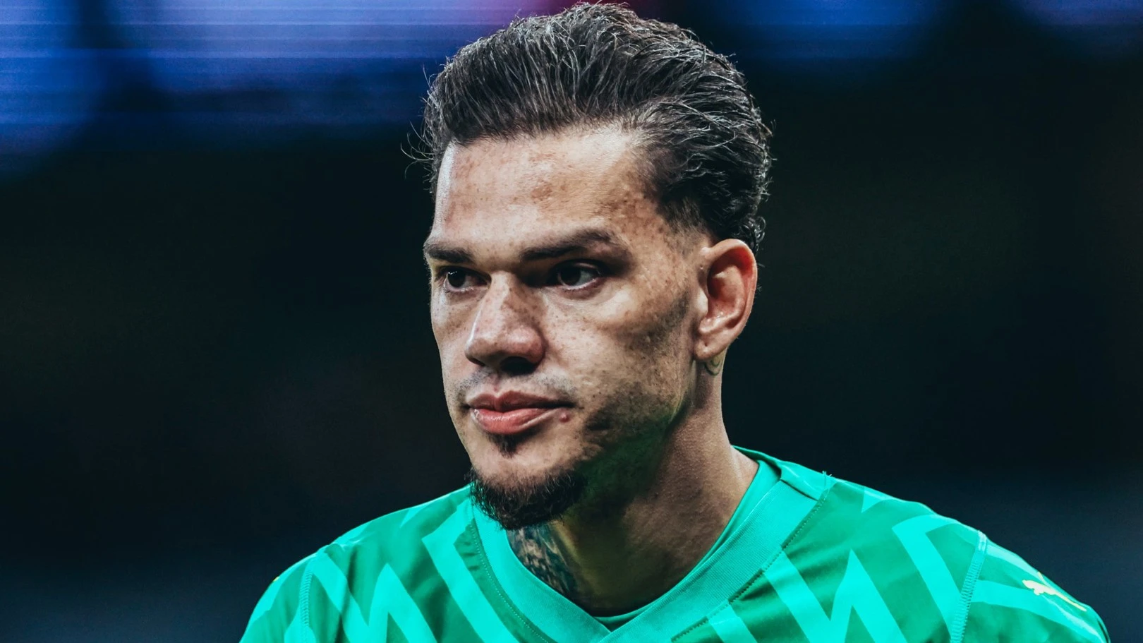 Ederson out for the rest of the season with fractured eye socket
