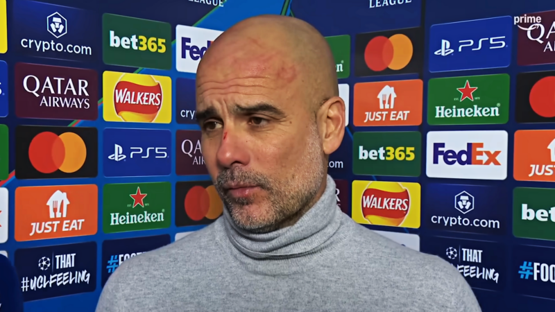 Pep Guardiola cuts and bruises on face after Man City vs Feyenoord draw